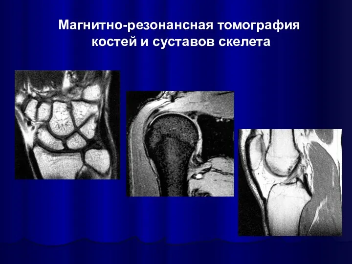 Магнитно-резонансная томография костей и суставов скелета