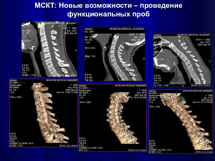 МСКТ: Новые возможности – проведение функциональных проб