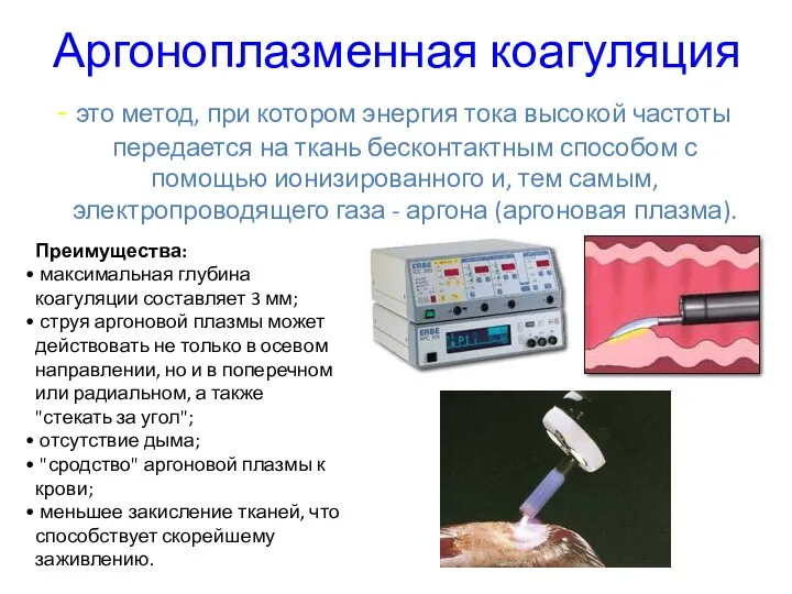 Аргоноплазменная коагуляция - это метод, при котором энергия тока высокой