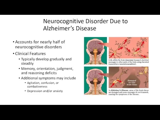 Neurocognitive Disorder Due to Alzheimer’s Disease Accounts for nearly half
