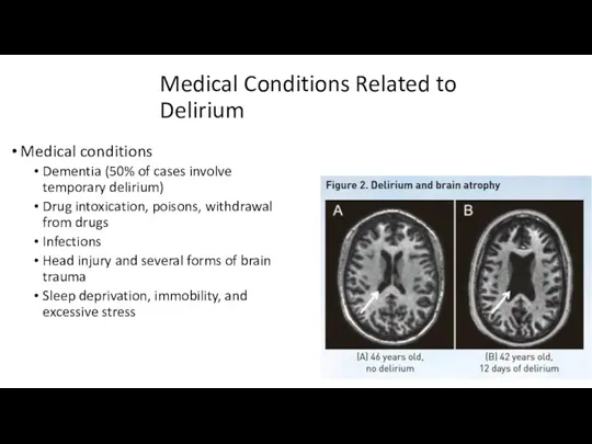 Medical Conditions Related to Delirium Medical conditions Dementia (50% of