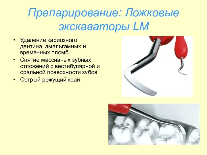 Препарирование: Ложковые экскаваторы LM Удаление кариозного дентина, амальгамных и временных