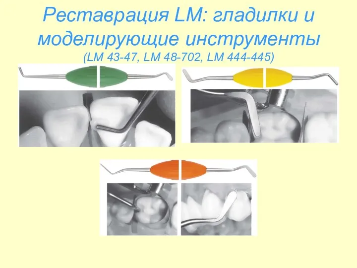 Реставрация LM: гладилки и моделирующие инструменты (LM 43-47, LM 48-702, LM 444-445)