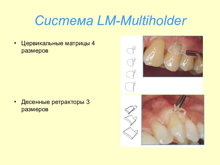 Система LM-Multiholder Цервикальные матрицы 4 размеров Десенные ретракторы 3 размеров