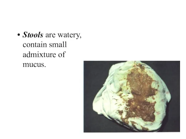 Stools are watery, contain small admixture of mucus.