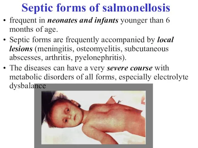 Septic forms of salmonellosis frequent in neonates and infants younger