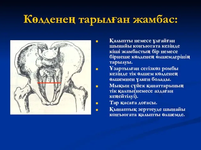 Көлденең тарылған жамбас: Қалыпты немесе ұлғайған шынайы конъюгата кезінде кіші