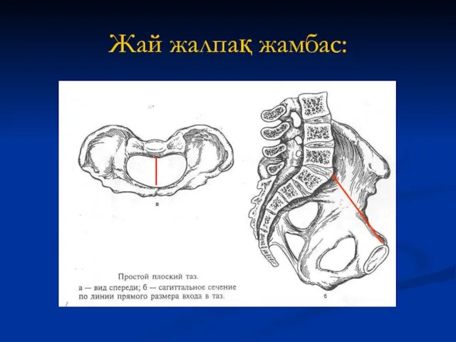 Жай жалпақ жамбас: