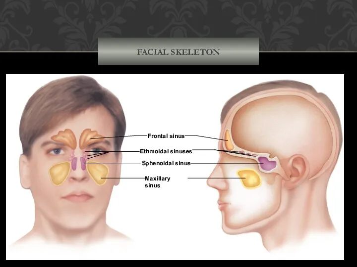 FACIAL SKELETON Frontal sinus Ethmoidal sinuses Sphenoidal sinus Maxillary sinus