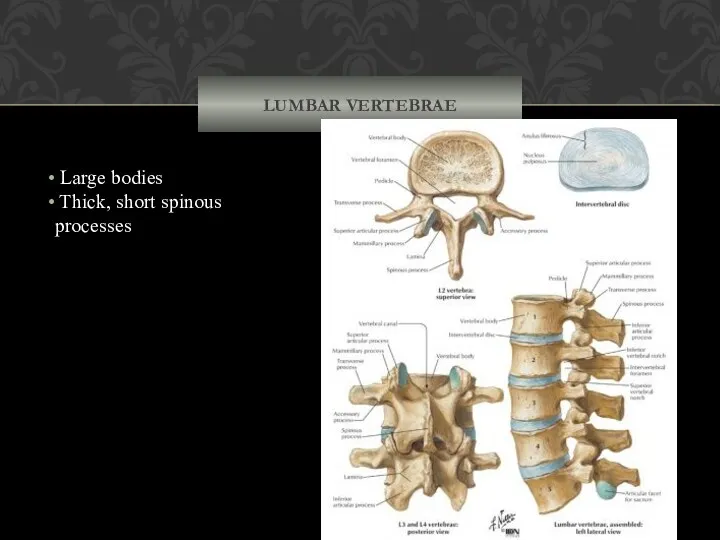 LUMBAR VERTEBRAE Large bodies Thick, short spinous processes (c) Lumbar
