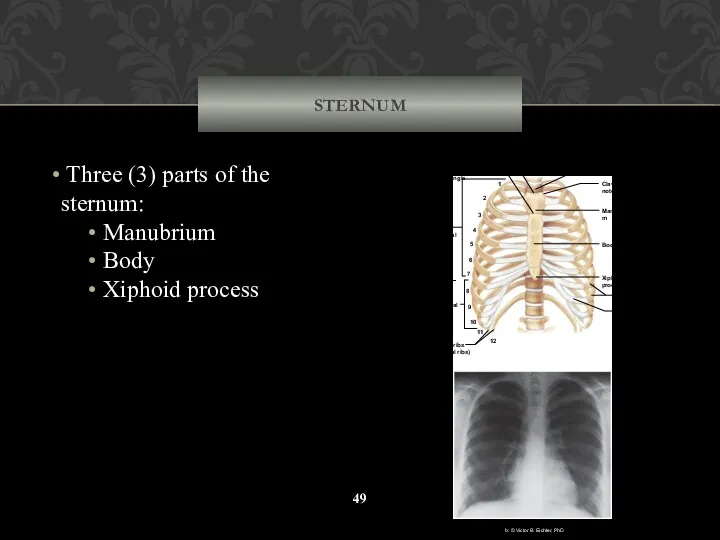 STERNUM Three (3) parts of the sternum: Manubrium Body Xiphoid