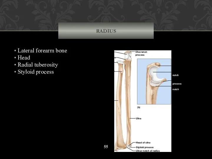 RADIUS Lateral forearm bone Head Radial tuberosity Styloid process Styloid