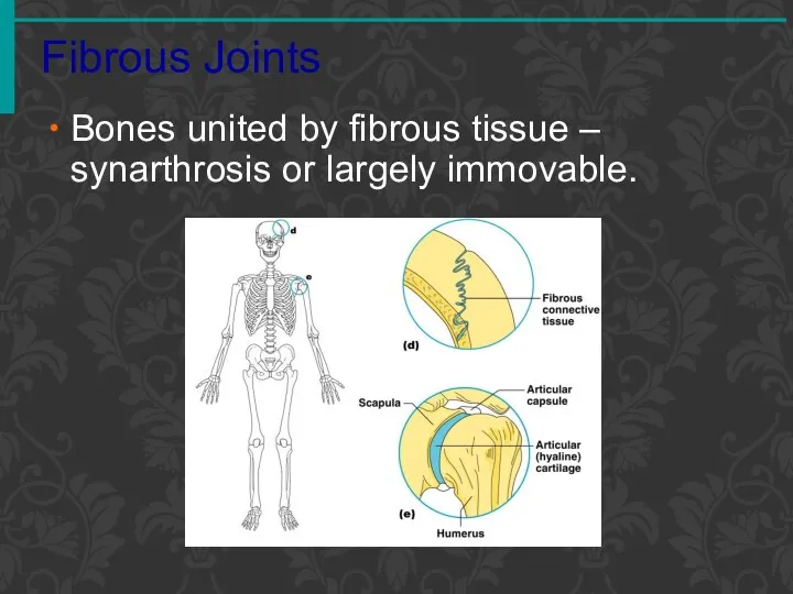 Fibrous Joints Bones united by fibrous tissue – synarthrosis or largely immovable.