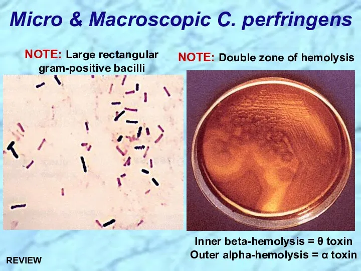 Micro & Macroscopic C. perfringens REVIEW