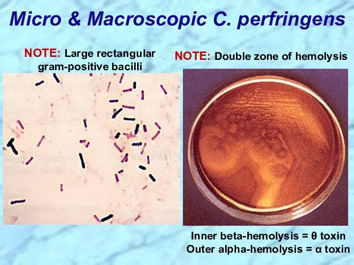 Micro & Macroscopic C. perfringens