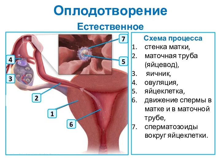 Оплодотворение Естественное Схема процесса стенка матки, маточная труба (яйцевод), яичник,