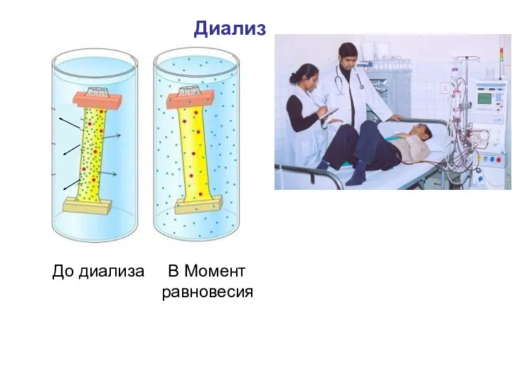 Диализ До диализа В Момент равновесия