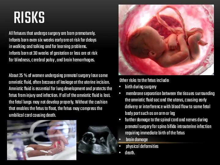 All fetuses that undergo surgery are born prematurely. Infants born