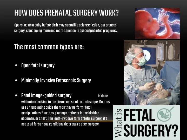 HOW DOES PRENATAL SURGERY WORK? The most common types are:
