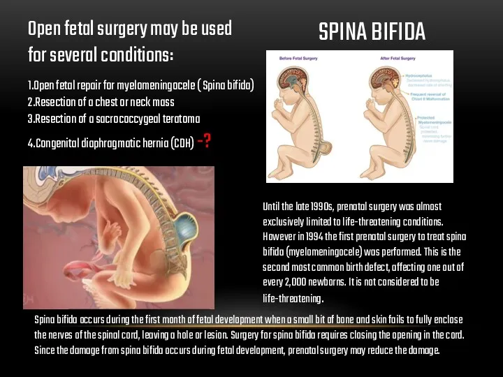 1.Open fetal repair for myelomeningocele ( Spina bifida) 2.Resection of