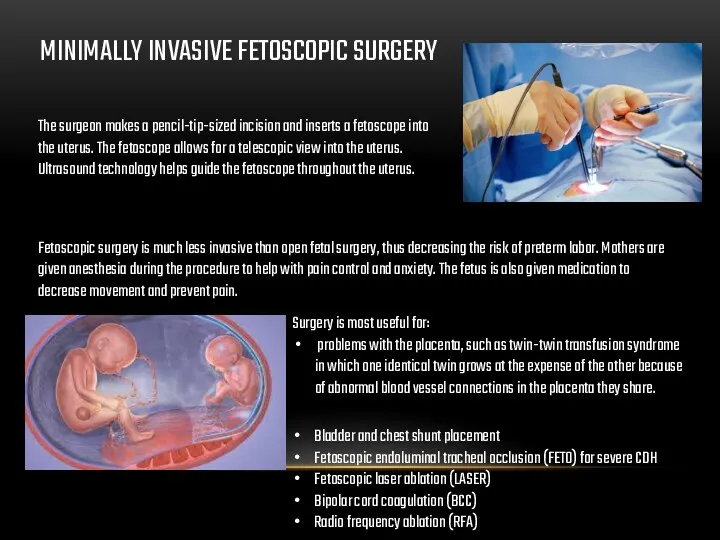 MINIMALLY INVASIVE FETOSCOPIC SURGERY The surgeon makes a pencil-tip-sized incision