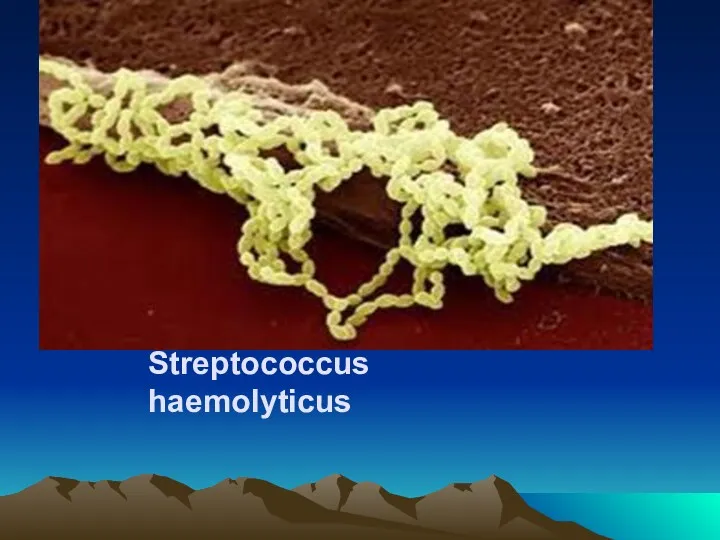 Streptococcus haemolyticus