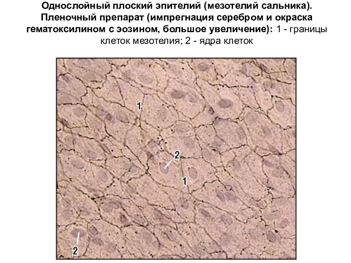 Однослойный плоский эпителий (мезотелий сальника). Пленочный препарат (импрегнация серебром и