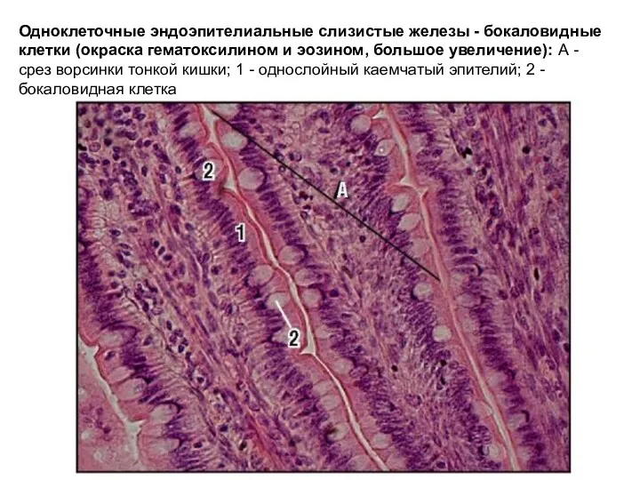 Одноклеточные эндоэпителиальные слизистые железы - бокаловидные клетки (окраска гематоксилином и