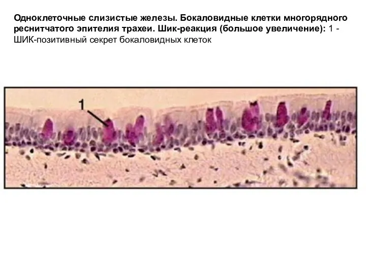 Одноклеточные слизистые железы. Бокаловидные клетки многорядного реснитчатого эпителия трахеи. Шик-реакция