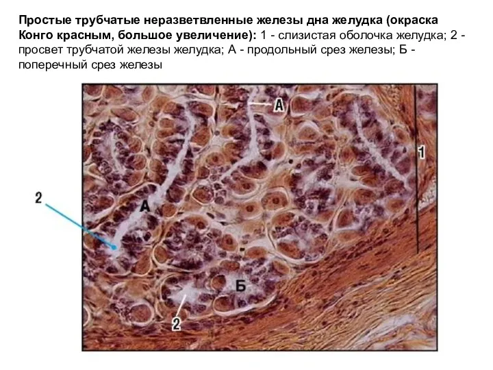 Простые трубчатые неразветвленные железы дна желудка (окраска Конго красным, большое