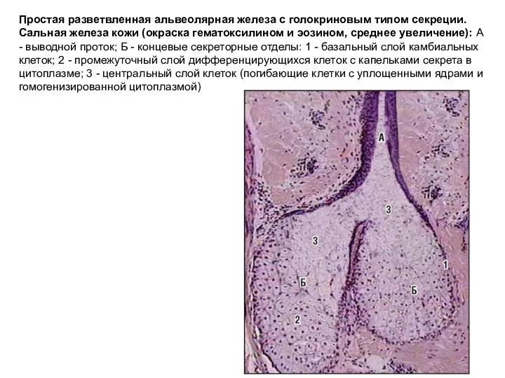 Простая разветвленная альвеолярная железа с голокриновым типом секреции. Сальная железа