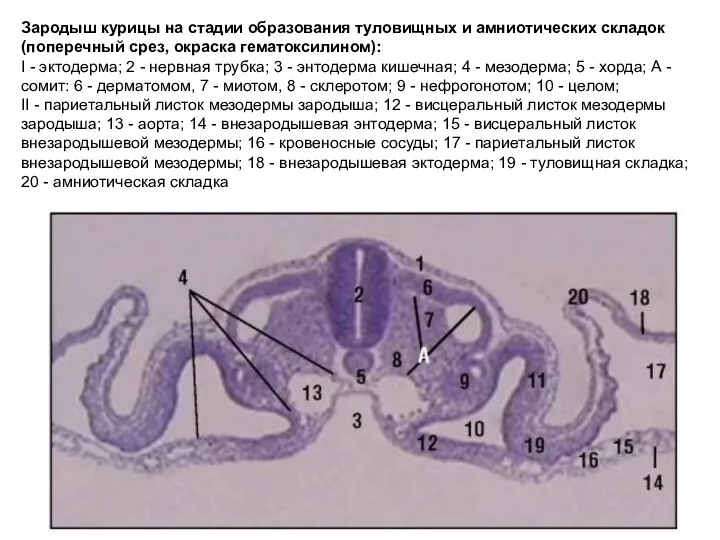 Зародыш курицы на стадии образования туловищных и амниотических складок (поперечный