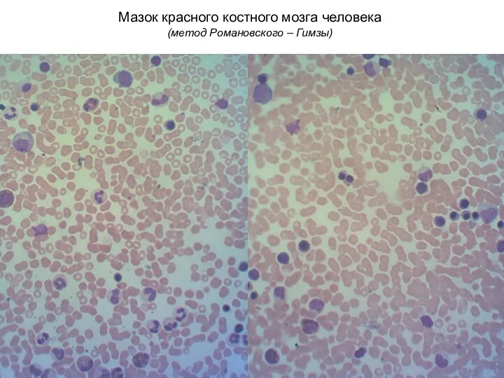 Мазок красного костного мозга человека (метод Романовского – Гимзы)