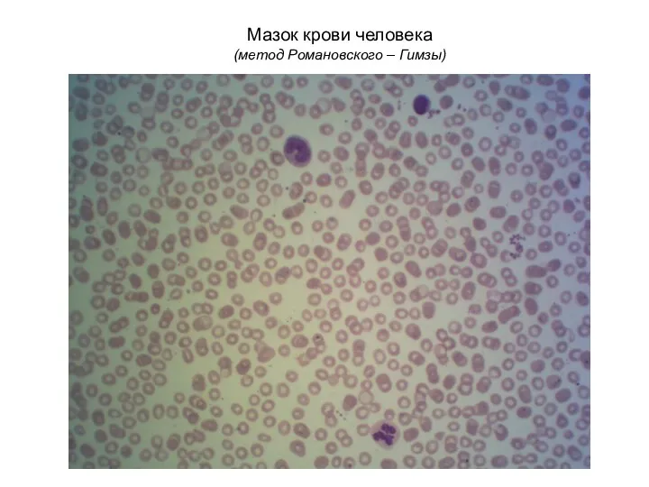 Мазок крови человека (метод Романовского – Гимзы)