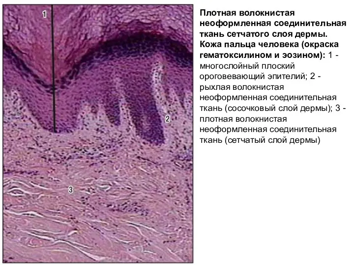 Плотная волокнистая неоформленная соединительная ткань сетчатого слоя дермы. Кожа пальца