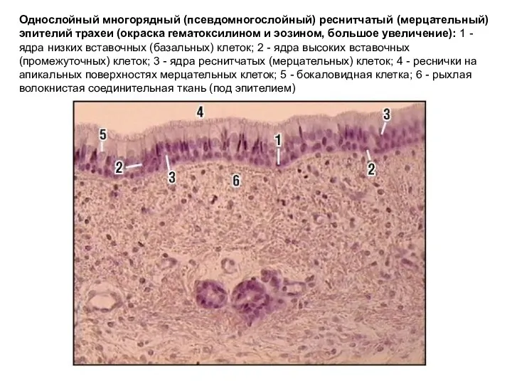 Однослойный многорядный (псевдомногослойный) реснитчатый (мерцательный) эпителий трахеи (окраска гематоксилином и