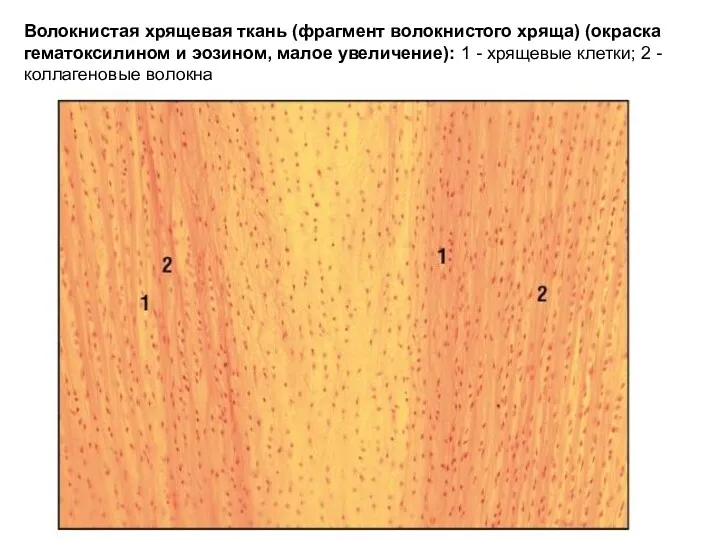 Волокнистая хрящевая ткань (фрагмент волокнистого хряща) (окраска гематоксилином и эозином,