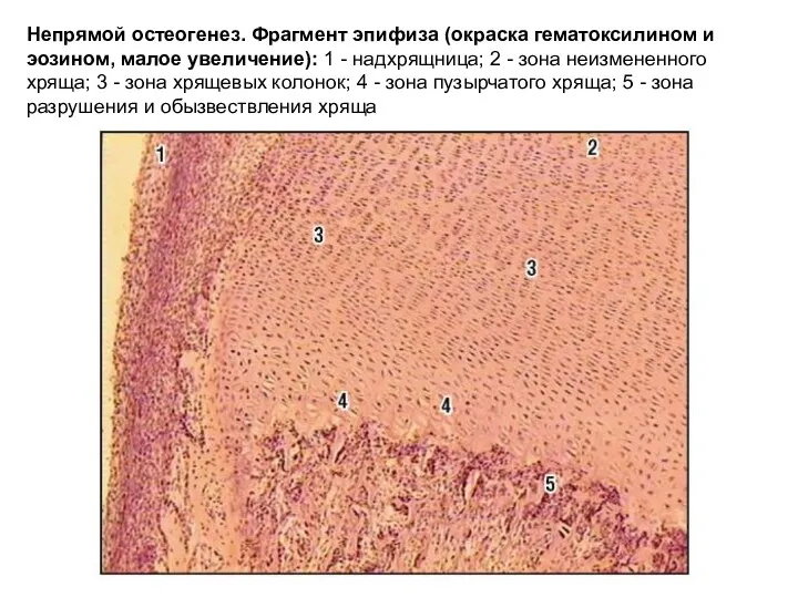 Непрямой остеогенез. Фрагмент эпифиза (окраска гематоксилином и эозином, малое увеличение):