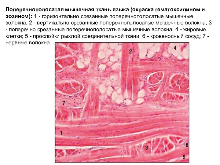 Поперечнополосатая мышечная ткань языка (окраска гематоксилином и эозином): 1 -