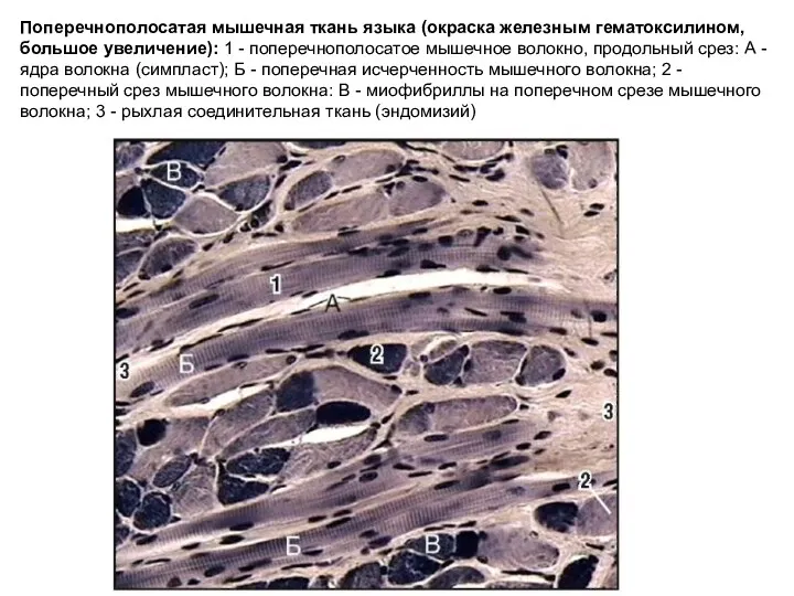 Поперечнополосатая мышечная ткань языка (окраска железным гематоксилином, большое увеличение): 1