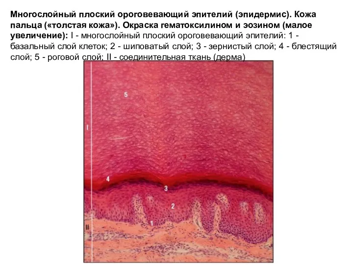 Многослойный плоский ороговевающий эпителий (эпидермис). Кожа пальца («толстая кожа»). Окраска