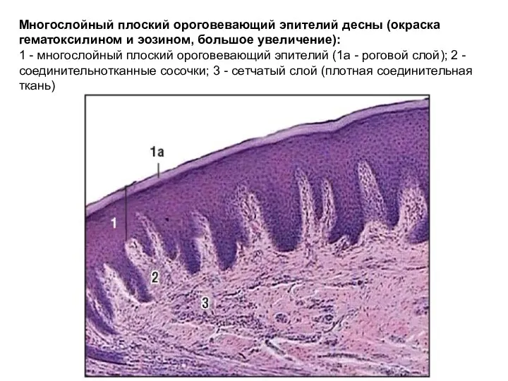 Многослойный плоский ороговевающий эпителий десны (окраска гематоксилином и эозином, большое