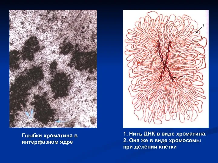 Глыбки хроматина в интерфазном ядре 1. Нить ДНК в виде