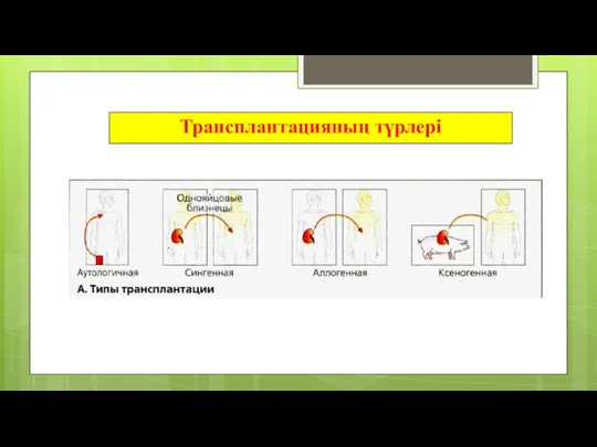 Трансплантацияның түрлері