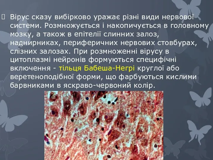 Вірус сказу вибірково уражає різні види нервової системи. Розмножується і
