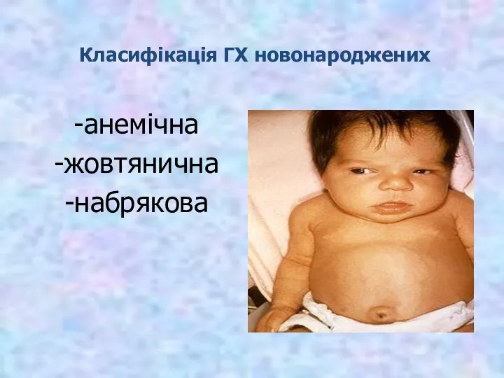 Класифікація ГХ новонароджених -анемічна -жовтянична -набрякова