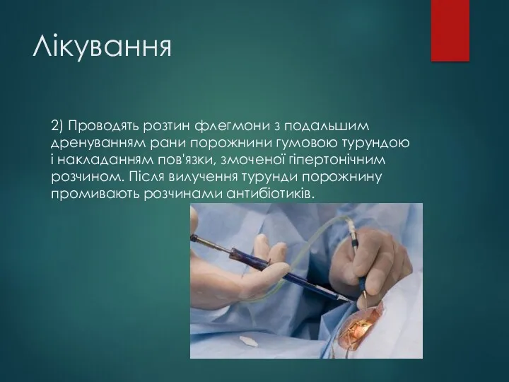 Лікування 2) Проводять розтин флегмони з подальшим дренуванням рани порожнини