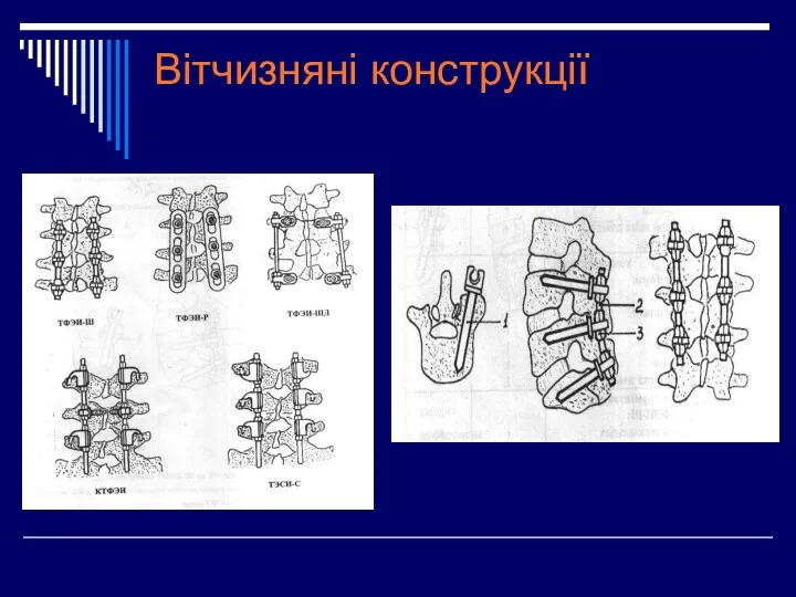 Вітчизняні конструкції