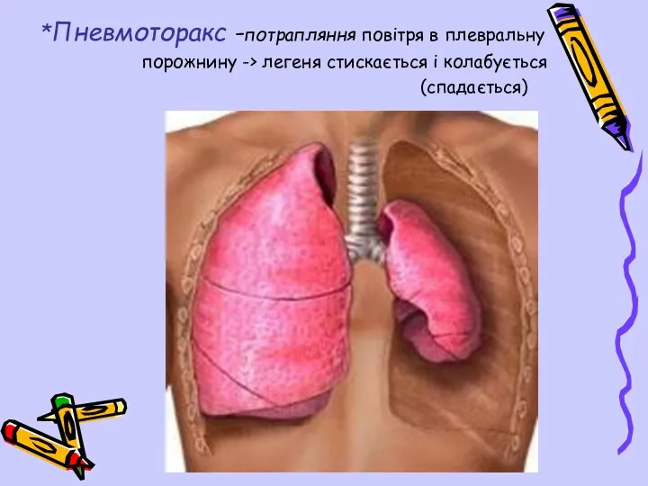 *Пневмоторакс -потрапляння повітря в плевральну порожнину -> легеня стискається і колабується (спадається)