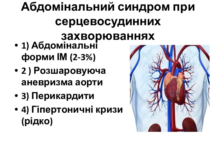 Абдомінальний синдром при серцевосудинних захворюваннях 1) Абдомінальні форми ІМ (2-3%)
